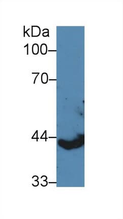 KRT13 / CK13 / Cytokeratin 13 Antibody (aa104-403)