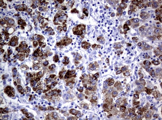 Monoclonal Mouse anti-Human AMACR / P504S Antibody (clone UMAB68, IHC, IF)
