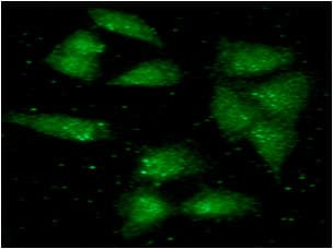 Monoclonal Mouse anti-Human ALDH2 Antibody (clone AT2C10, WB)