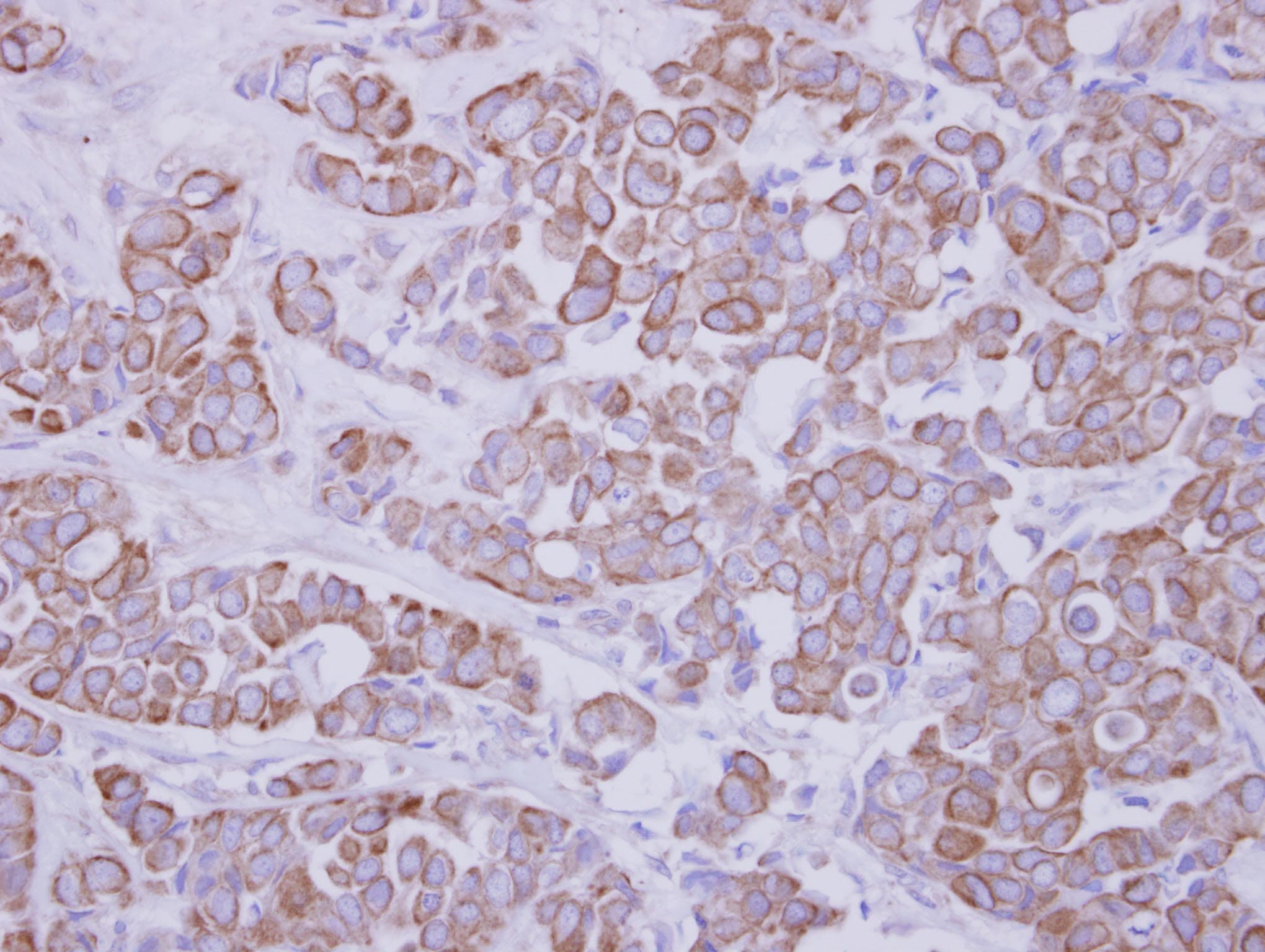 Polyclonal Rabbit anti-Human GTDC1 Antibody (IHC, WB)