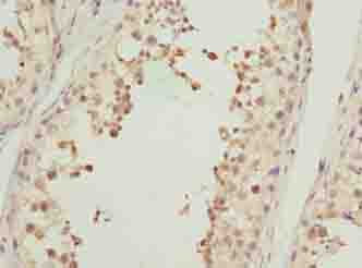 ACTL7B Antibody