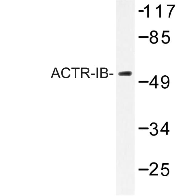 ACVR1B / ALK4 Antibody (Gly111)