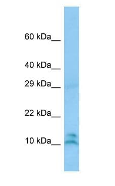 LALBA / Alpha Lactalbumin Antibody (aa24-73)