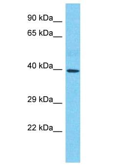SMAD6 Antibody (aa11-60)