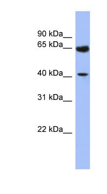 Polyclonal Rabbit anti-Human L3 / LASS2 Antibody (N-Terminus, WB)