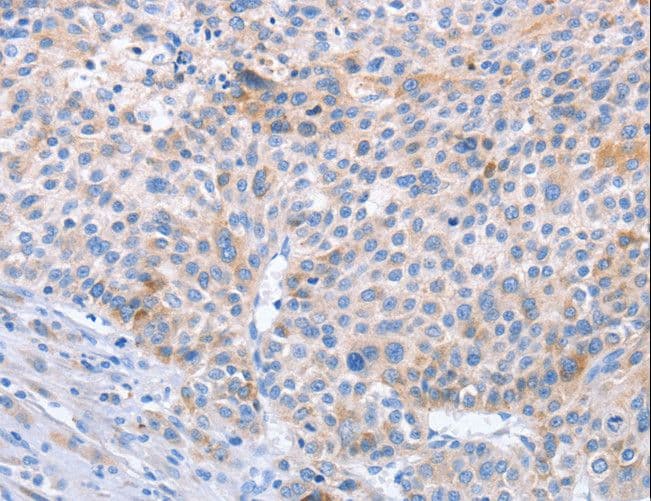 Polyclonal Rabbit anti-Human STK4 Antibody (IHC, WB)