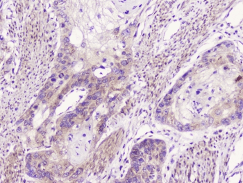 Polyclonal Rabbit anti-Human GOLGA2 / GM130 Antibody (IHC, WB)