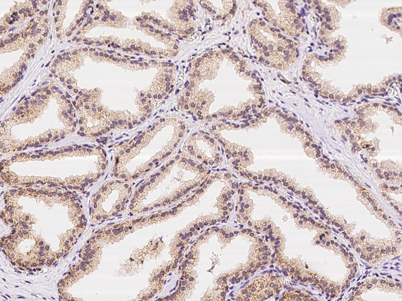 Polyclonal Rabbit anti-Human ZNF415 Antibody (IHC)