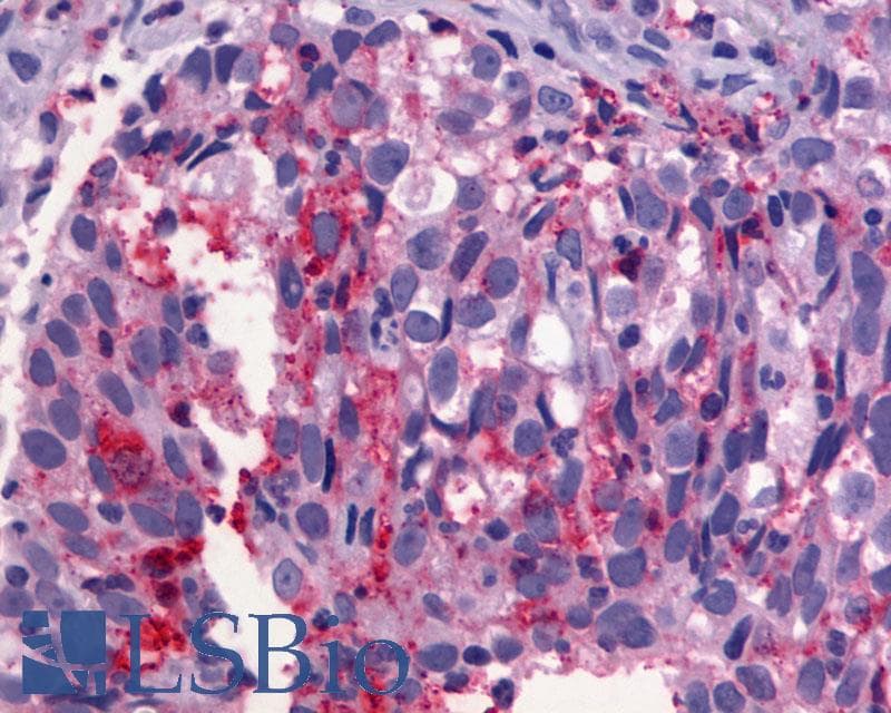 IHC-plus™ Polyclonal Rabbit anti-Human ADGRG1 / GPR56 Antibody (Cytoplasmic Domain, IHC)