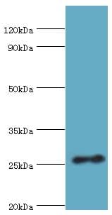 Polyclonal Rabbit anti-Human VAPB Antibody (aa10-222, WB)