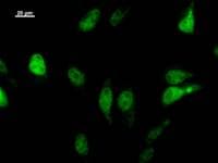 Monoclonal Mouse anti-Human LHX2 Antibody (clone LHX2A12G1, IF, WB)