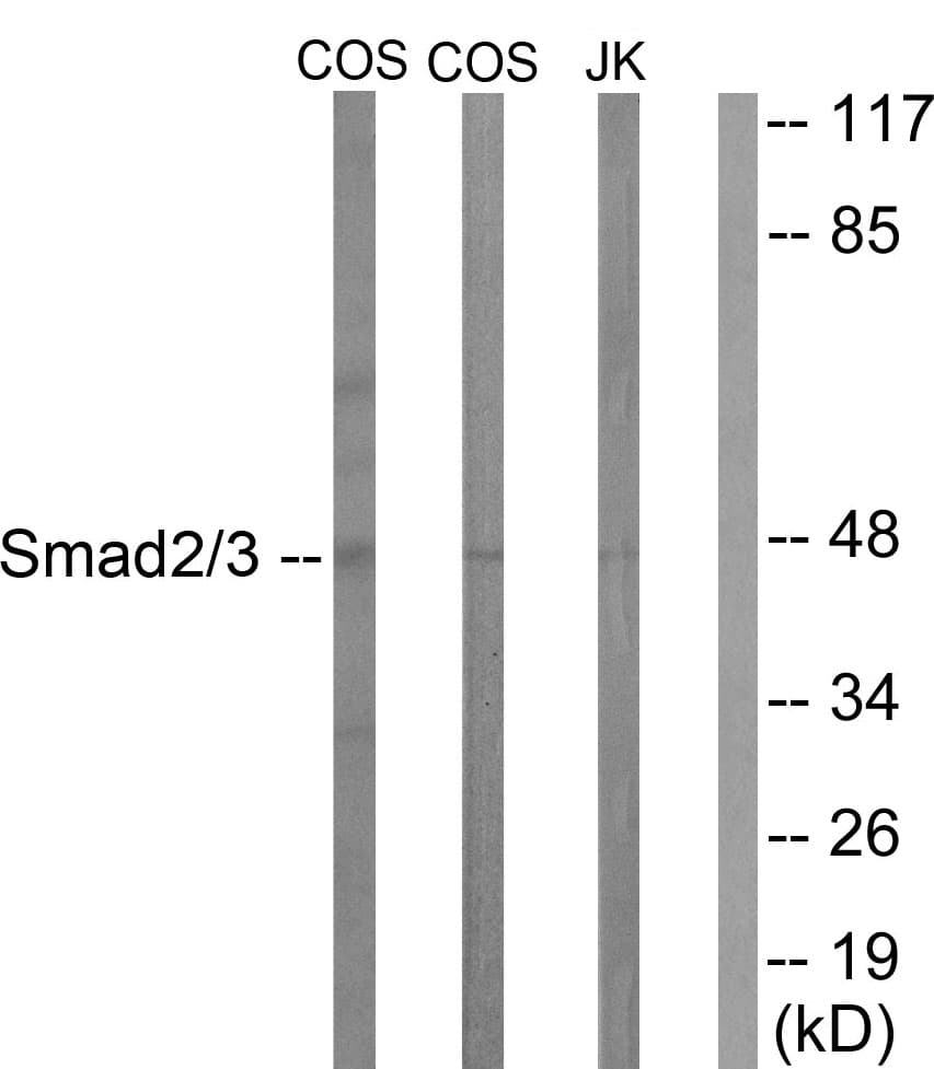 IHC-plus™ Polyclonal Rabbit anti-Human SMAD2+3 Antibody (aa1-50, IHC, WB)