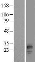 FAM219B / C15orf17 Protein (Over-Expression Lysate Myc-DDK (Flag))
