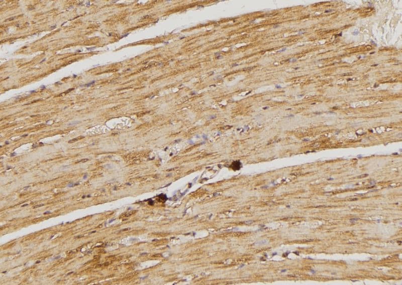 Polyclonal Rabbit anti-Human DUSP9 Antibody (IHC, IF, WB)