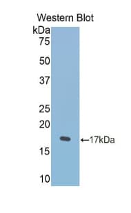 LF / LTF / Lactoferrin Antibody (aa550-668)