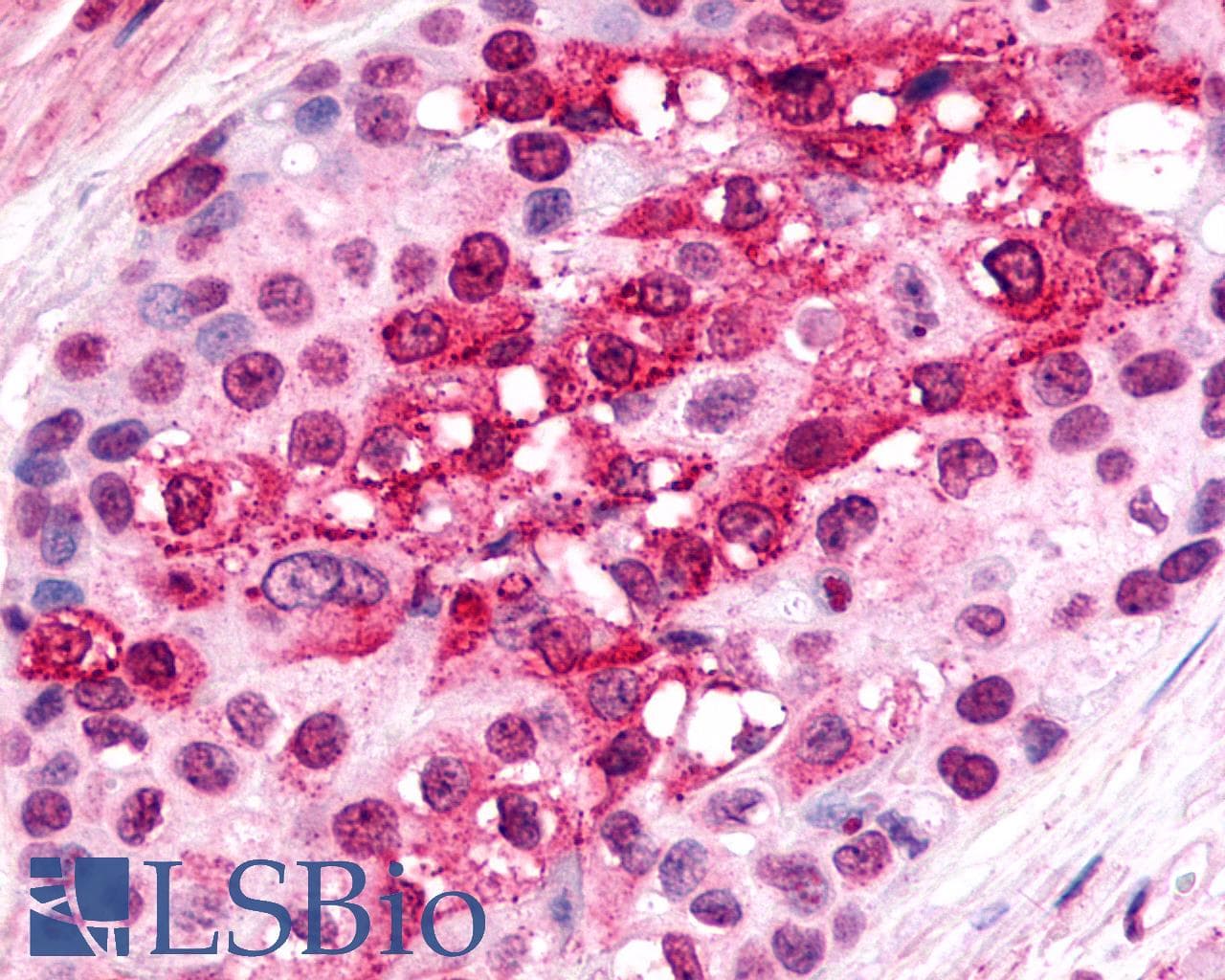 IHC-plus™ Polyclonal Rabbit anti-Human CXCR6 Antibody (Cytoplasmic Domain, IHC)
