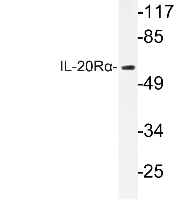 IL20RA Antibody (aa173-222)