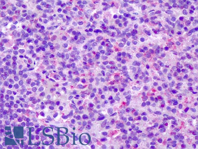 IHC-plus™ CCR7 Antibody (C-Terminus)