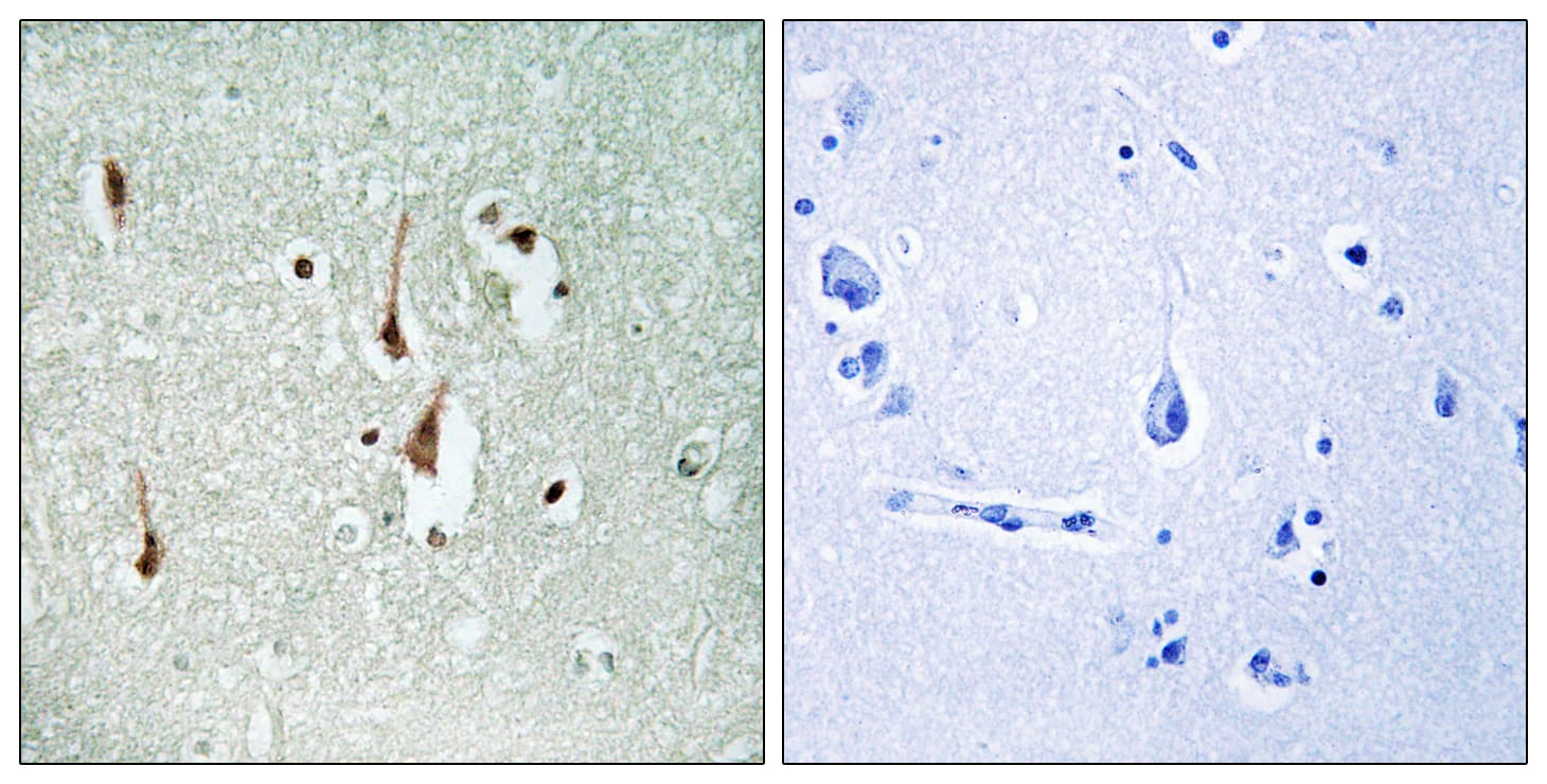Polyclonal Rabbit anti-Human CCND1 / Cyclin D1 Antibody (aa246-295, IHC, WB)
