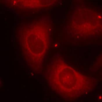 Polyclonal Rabbit anti-Human LIMK2 Antibody (phospho-Thr505, IHC, IF, WB)