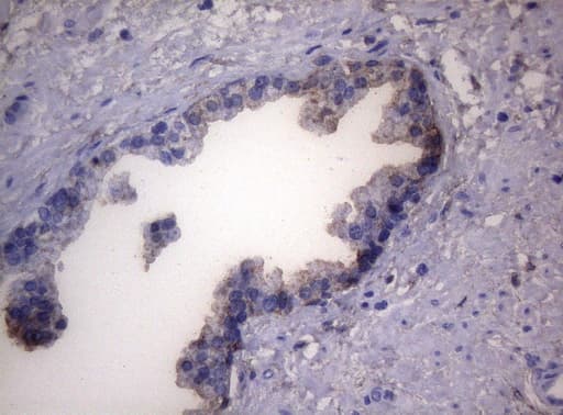 LGALS3 / Galectin 3 Antibody (clone OTI8E3)