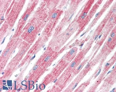 IHC-plus™ Polyclonal Rabbit anti-Human NDUFS7 Antibody (aa119-146, IHC, WB)