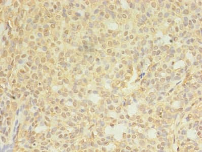 CTPS Antibody (aa79-388)