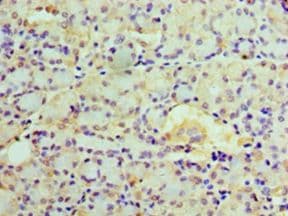 EPHX1 / Epoxide Hydrolase 1 Antibody (aa1-455)