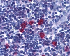 BAFF Receptor / CD268 Antibody