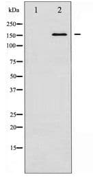 Polyclonal Rabbit anti-Human CML / BCR Antibody (WB)