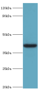Polyclonal Rabbit anti-Human ADH4 Antibody (aa1-380, IHC, WB)