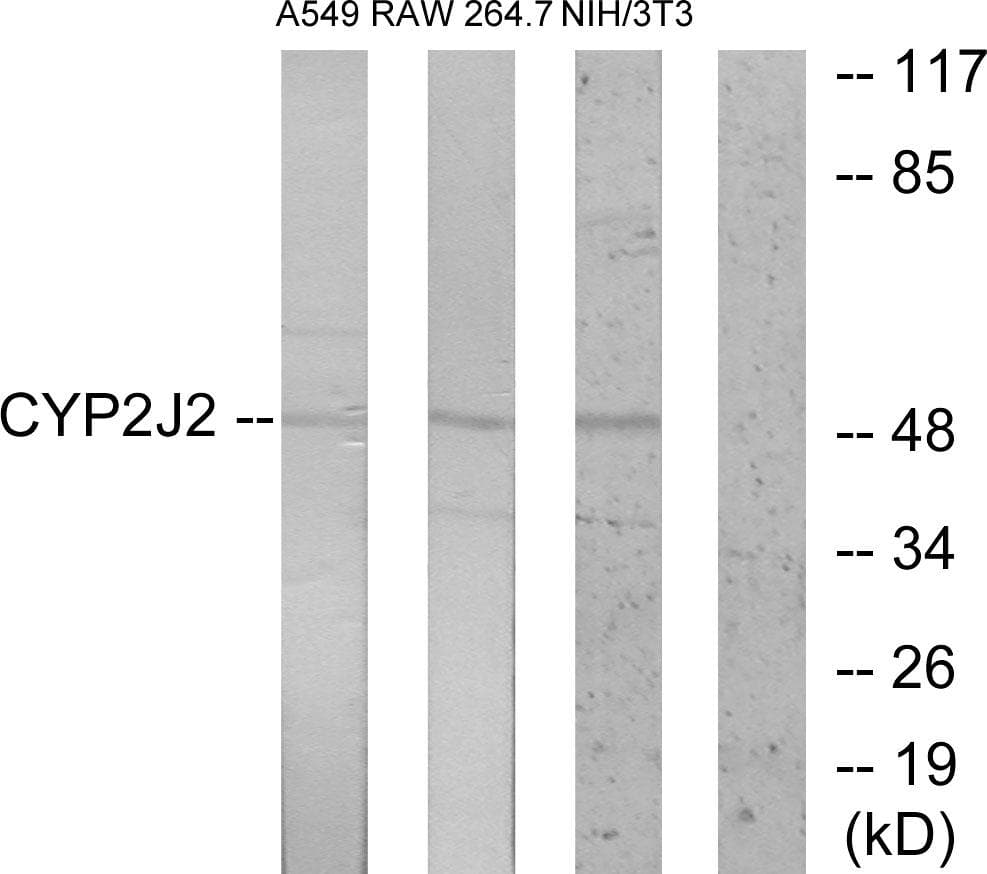 CYP2J2 Antibody