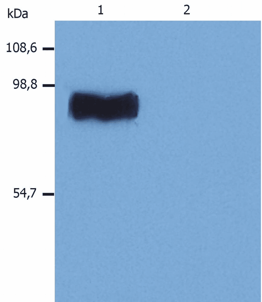 IHC-plus™ GOK / STIM1 Antibody (C-Terminus, clone CDN3H4)
