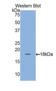 RBP1 / CRBP Antibody (aa1-135)