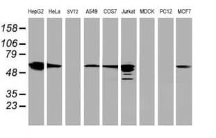 Monoclonal Mouse anti-Human FDFT1 / Squalene Synthase Antibody (clone OTI2F10, IHC, IF, WB)
