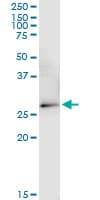 VDAC2 Antibody (clone 3D2)