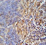 Polyclonal Rabbit anti-Human HLA-DRB5 Antibody (aa43-70, IHC, WB)