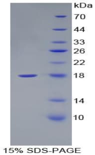 Human DHH / Desert Hedgehog Protein (Recombinant His)