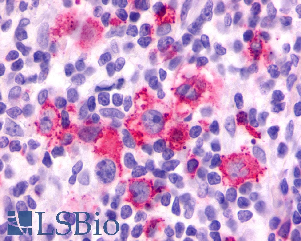 PathPlus™ F2RL3 / PAR4 Antibody (Cytoplasmic Domain)