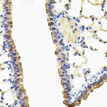 Polyclonal Rabbit anti-Human CARS1 / CARS Antibody (IHC, IF, WB)
