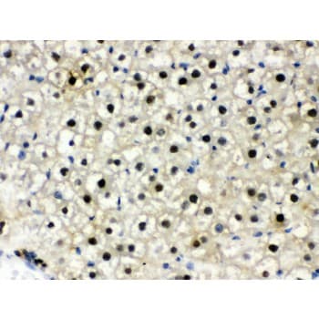 DDB1 Antibody (aa1011-1140)