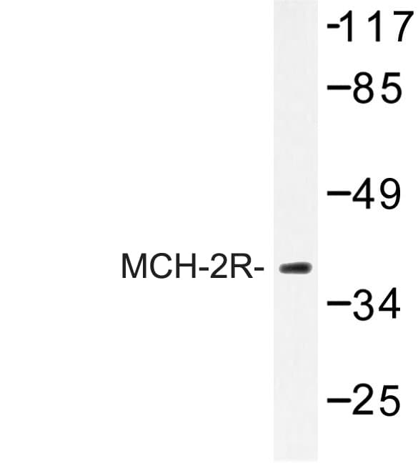 Polyclonal Rabbit anti-Human MCHR2 Antibody (Met332, IF, WB)