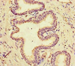 MCIDAS / MCIN Antibody