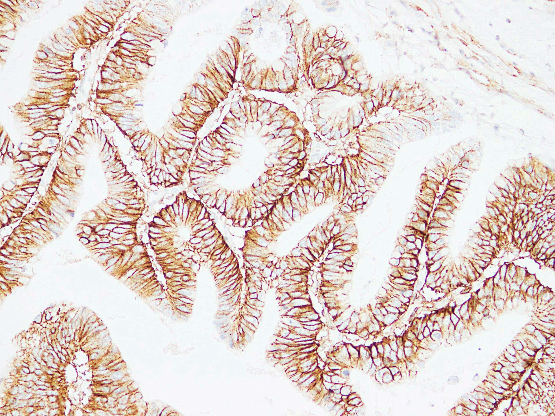 IHC-plus™ CD44 Antibody (clone ABT-CD44)