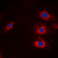IHC-plus™ Polyclonal Rabbit anti-Human NEDL2 / HECW2 Antibody (Internal, IHC, IF, WB)