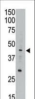 APOBEC3G / CEM15 Antibody (aa118-148)