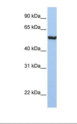 Polyclonal Rabbit anti-Human SLC39A5 / ZIP5 Antibody (aa38-87, IHC, WB)