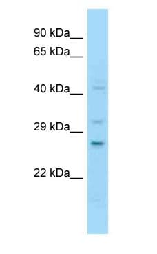 NOTCH2NL Antibody (C-Terminus)