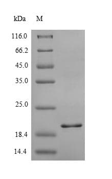 Human INSR / Insulin Receptor Protein (Recombinant 6His-SUMO, N-terminus)