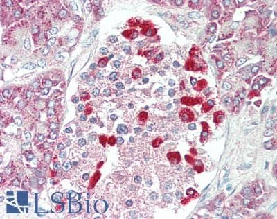 IHC-plus™ Polyclonal Rabbit anti-Human MTHFD2 Antibody (IHC, WB)
